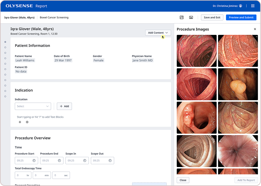 OlySense Report screen showing patient information and procedure images for a colonoscopy
