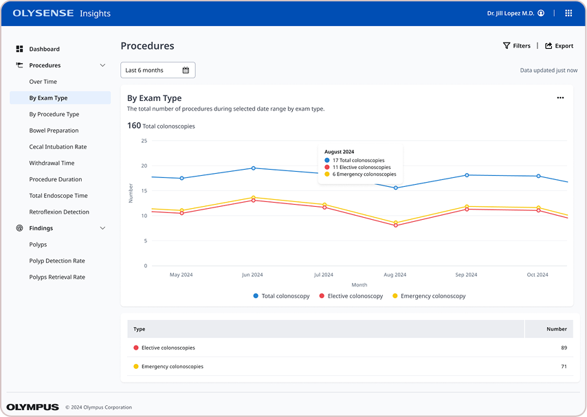 OlySense Insights dashboard charting colonoscopy procedure volume over time